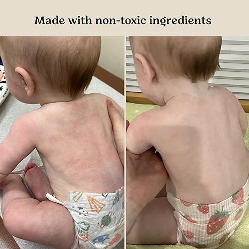 Miniatura 4 de Roe Wellness - Suero para bebés con protección probiótica hidratante para el cuidado de la piel  Hidrata, calma, ingredientes limpios y seguro para