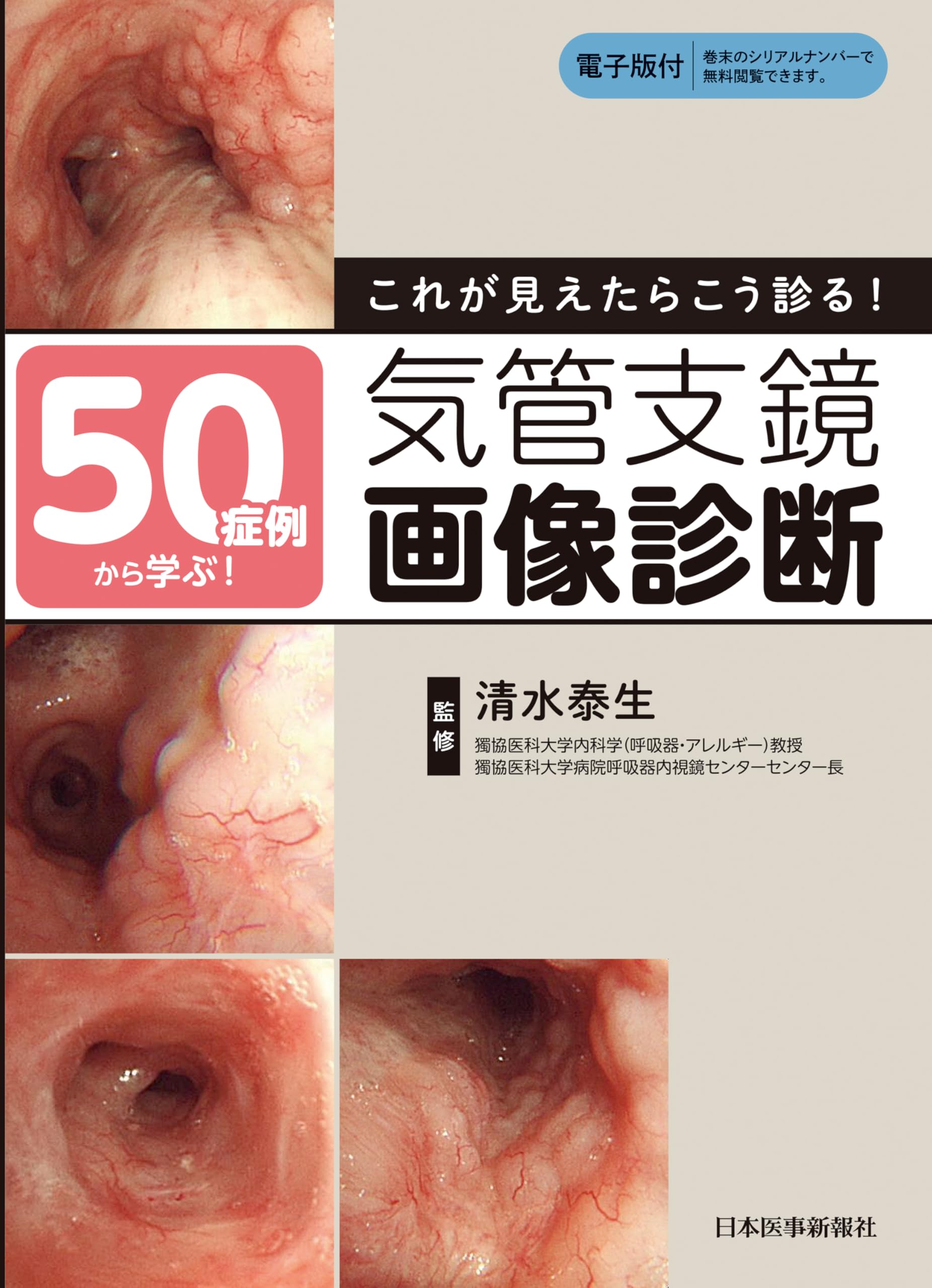 50症例から学ぶ！これが見えたらこう診る！ 気管支鏡画像診断 | 清水
