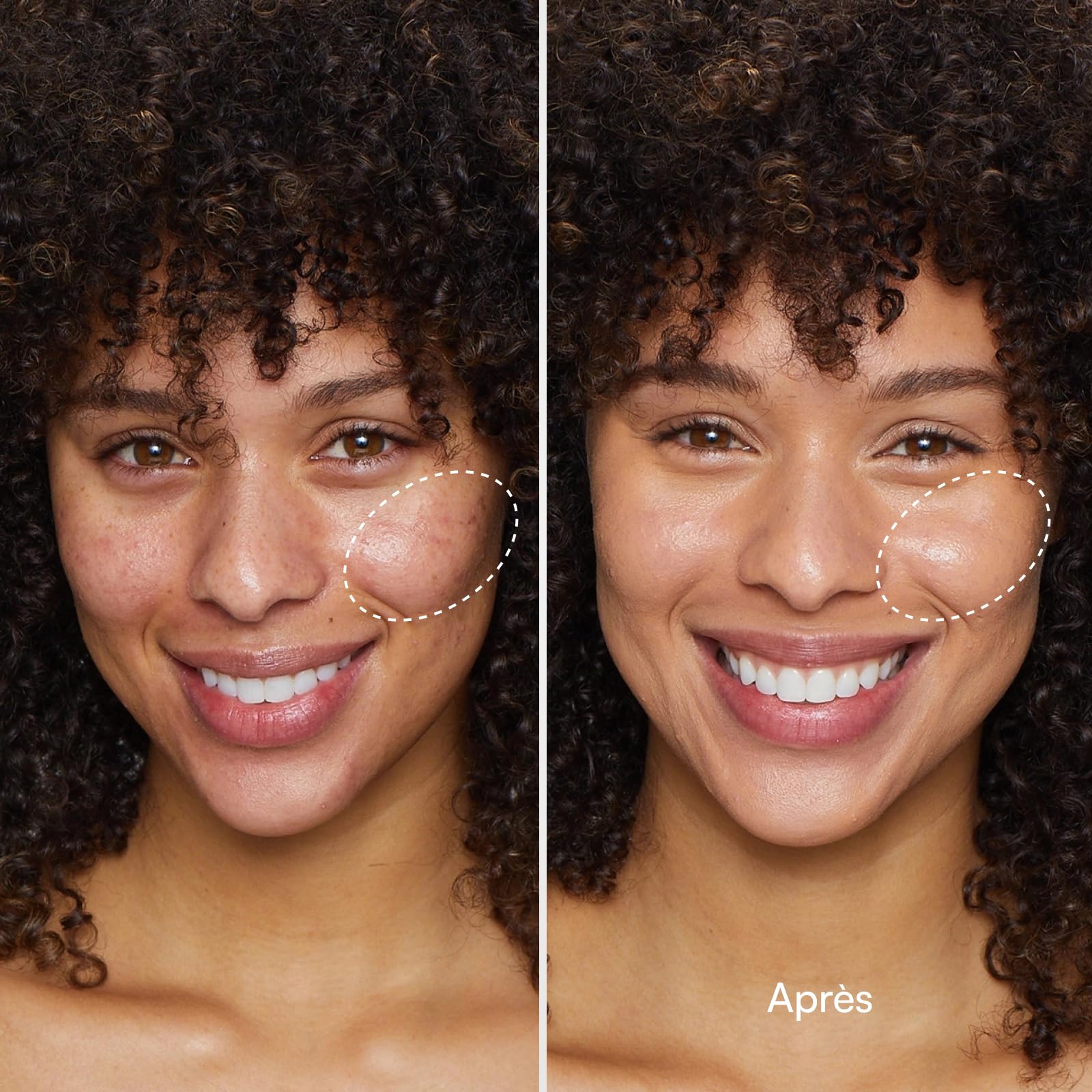 INIA Glow Masque facial beauté sans fil – Masque rechargeable pour le soin personnel à domicile et en voyage
