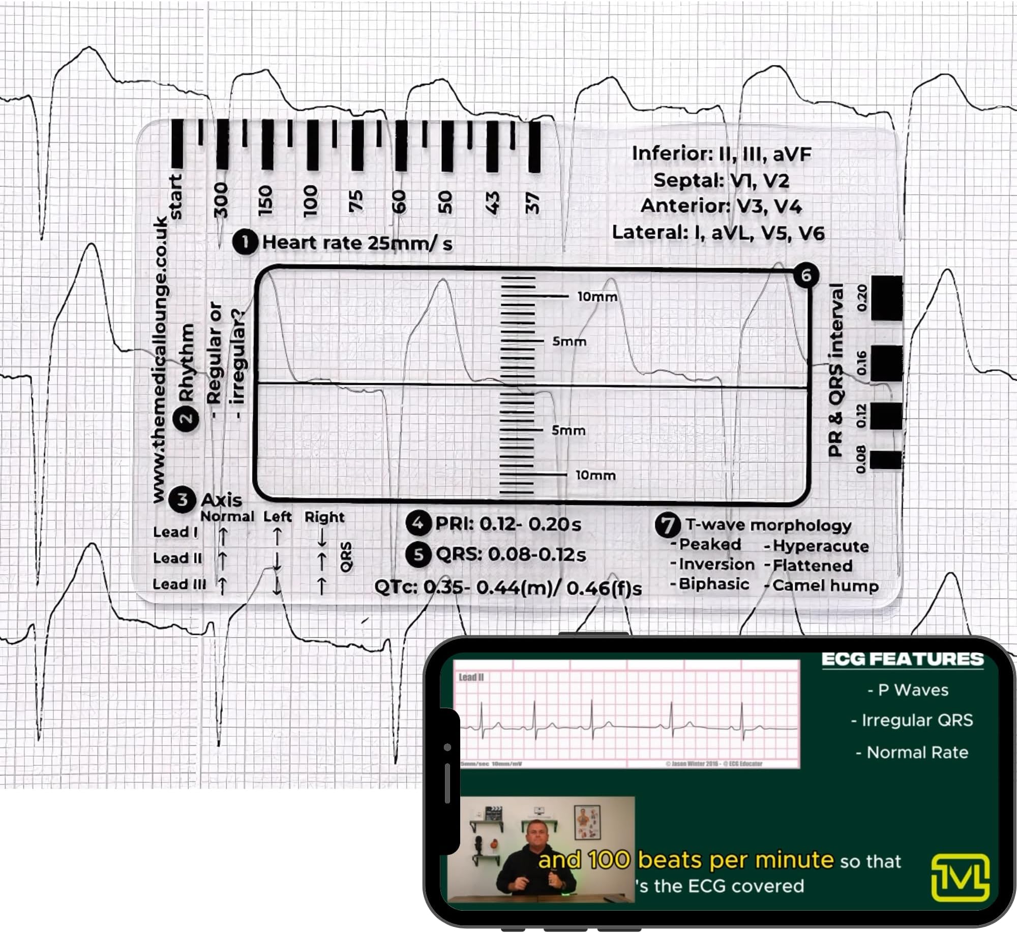 ECG Ruler with Heart Rate, Axis, PR Interval, QRS Duration, QTc Interval, and T-Wave Morphology Indicators
