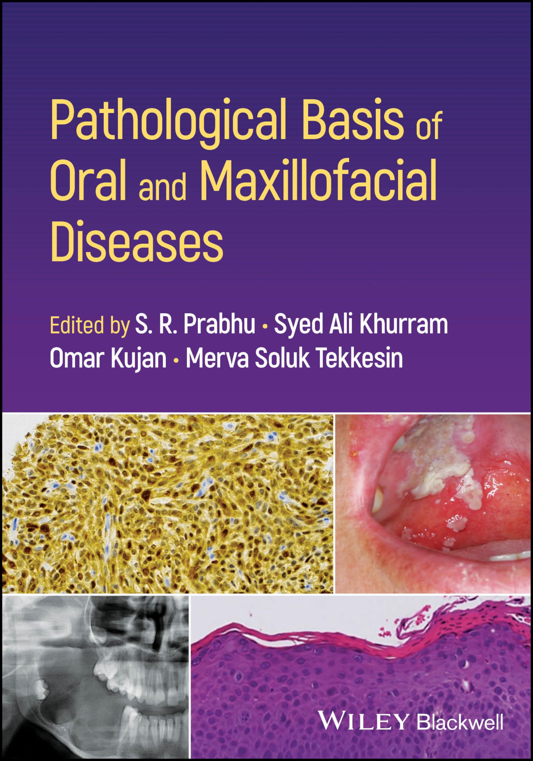 Pathological Basis of Oral and Maxillofacial Diseases by S. R... - 9781119989202