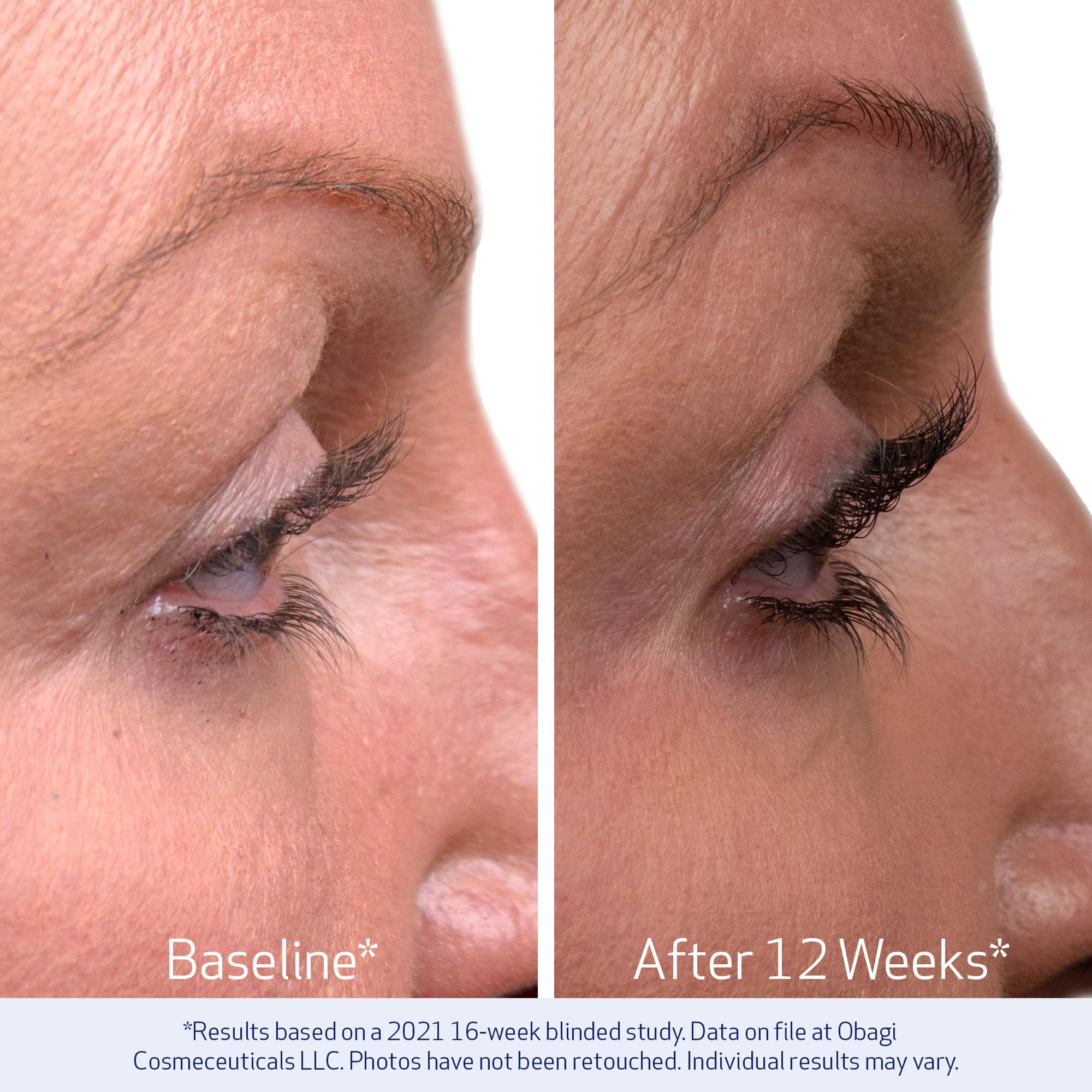 Obagi Nu-Cil Eyelash Enhancing Serum 3ml - Conditioning Lash Serum for Longer Fuller Healthier-Looking Eyelashes, Nourishes Sparse & Brittle Lashes, Once-Daily Cosmetic Lash Enhancer, Precise Applicator