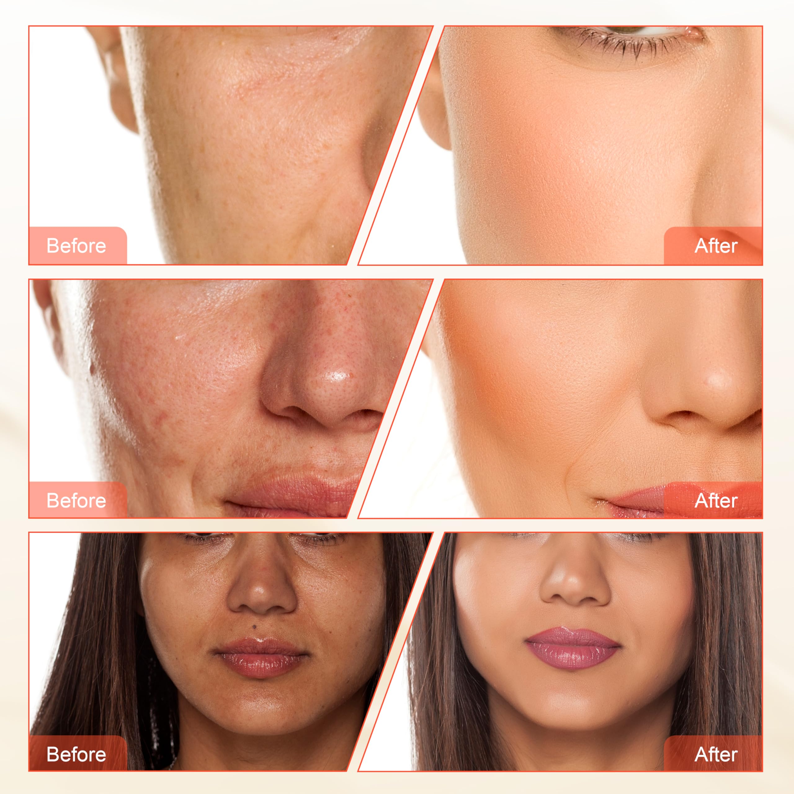 Elitzia Diamond Microdermabrasion & Hydra Spray Dispositivo de rejuvenecimiento de la piel 2 en 1 - para acné, puntos negros, refinamiento de poros ETNF108