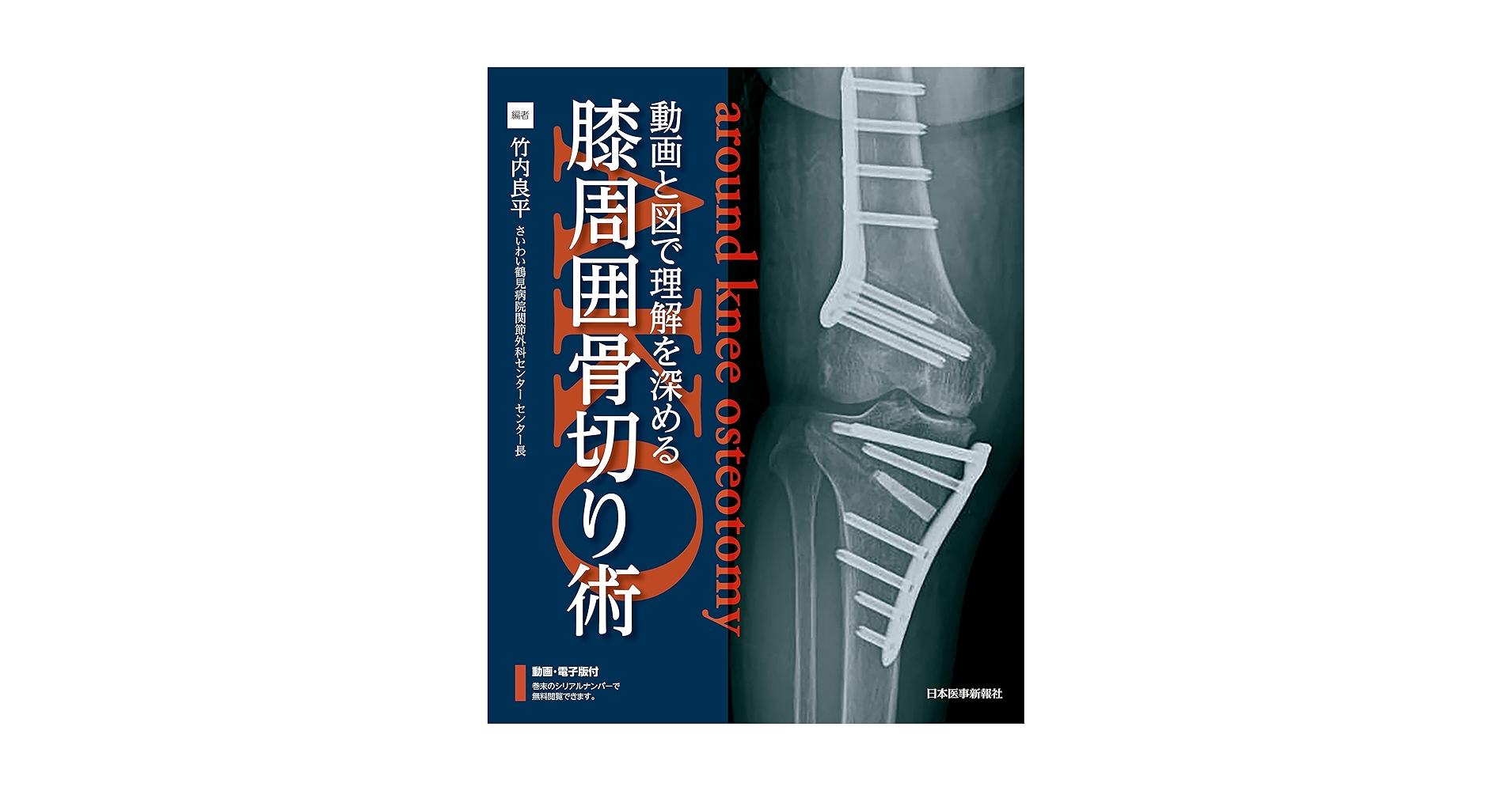 膝関節の手術/中山書店/黒坂昌弘（単行本） 膝関節の手術/中山書店/黒坂昌弘（単行本） 膝関節の手術/中山