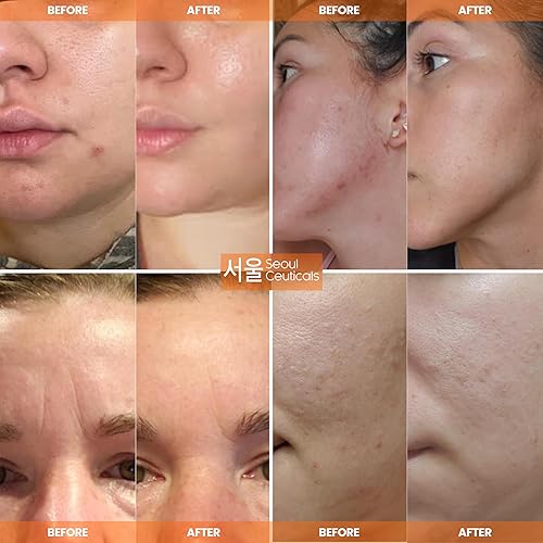 Miniatura 3 de SeoulCeuticals Snail Mucin Moisturizer 97.5% - Korean Skin Care Snail Repair Cream - Day & Night Anti Aging K Beauty Skincare Cruelty Free 2oz