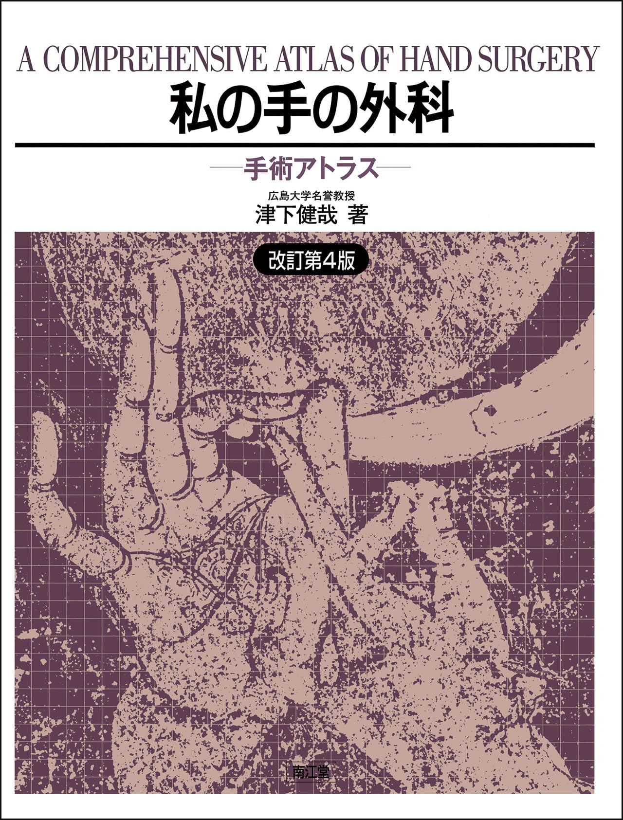 私の手の外科(改訂第4版): 手術アトラス | 津下 健哉 |本 | 通販 | Amazon