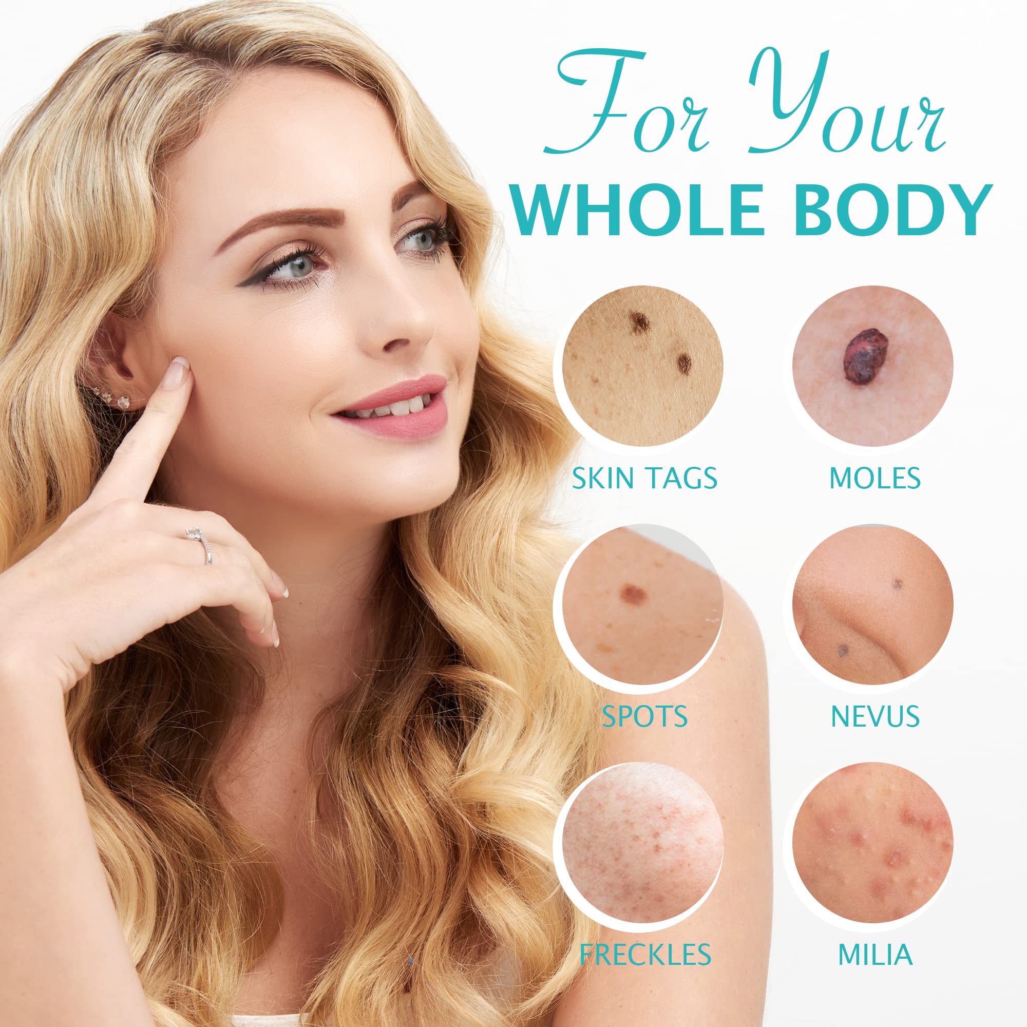 Buy Skin Tag Remover Cream, Wart & Mole Remover Quickly and Easily