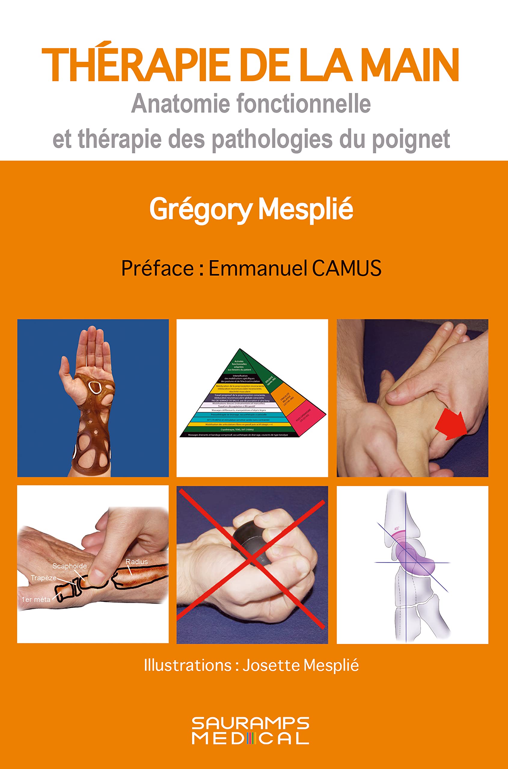 Thérapie de la main: Anatomie fonctionnelle et thérapie des pathologies du poignet