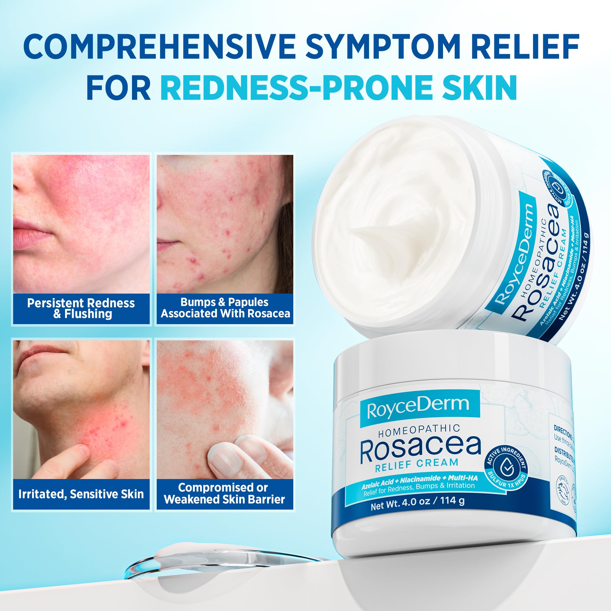 Amazon.com: Roycederm Rosacea Treatment for Face with Azelaic Acid
