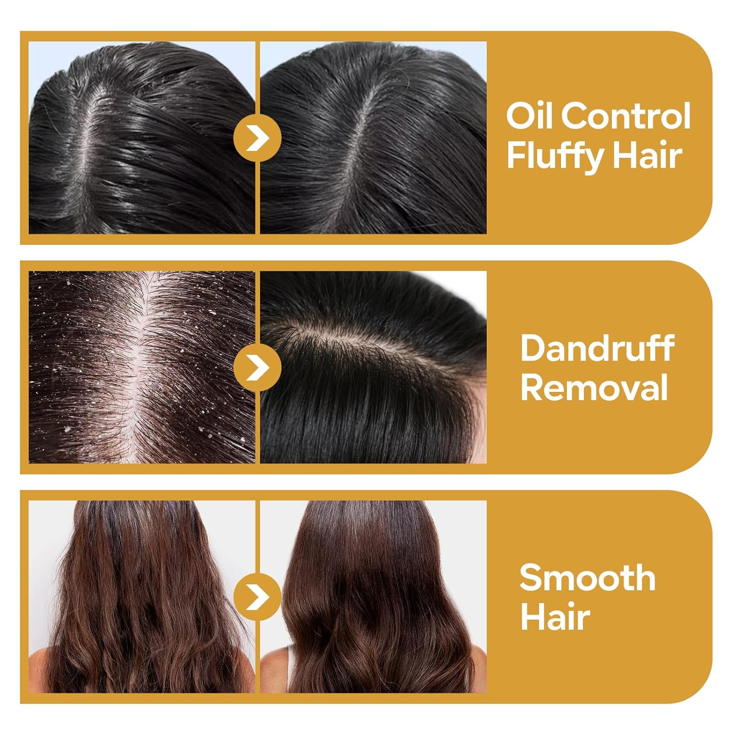 KYDA 3 Pack Shampoo Bar for Hair Growth, Bamboo Charcoal&Black Sesame Seeds, Rice Water&Protein, Ginger&Lemon, Organic Shampoo Soap, Paraben, Sulfate & Silicone Free - Image 5