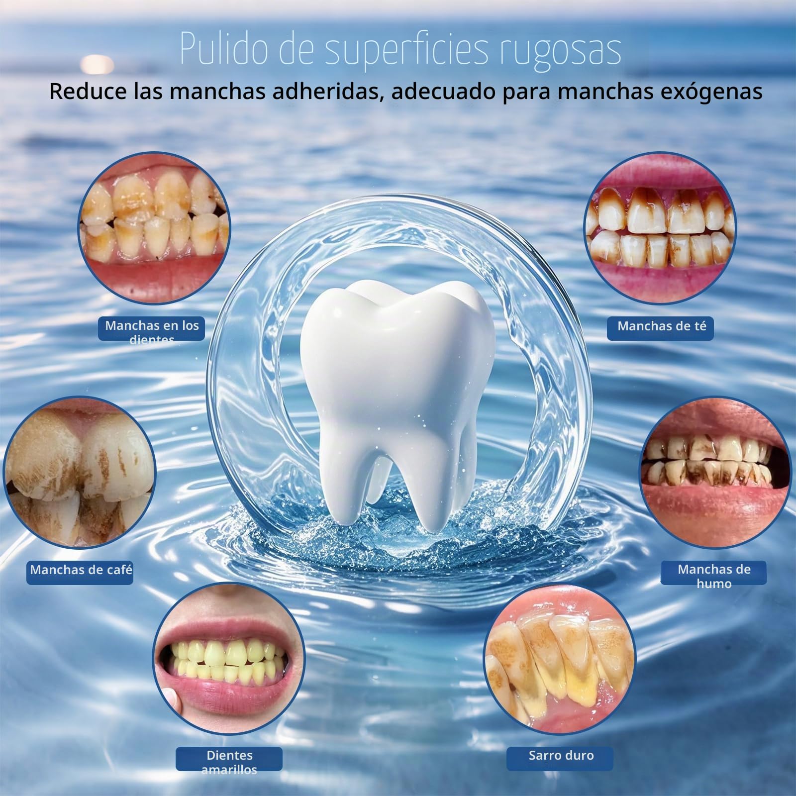 Pulidor dental, kit de Blanqueamiento dental recargable para limpieza y blanqueamiento dental, con 3 tipos de pasta de pulido dental, 5 cabezas de cepillo, 5 modos de velocidad, lámparas led