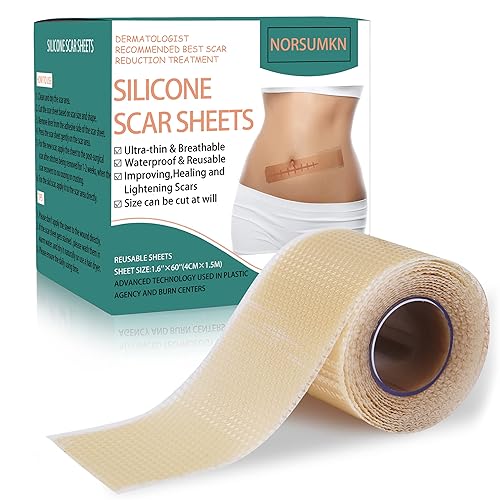 Cinta de silicona para cicatrices de 1.6 x 60 pulgadas, hoja de silicona reutilizable para tratamiento de cicatrices, eliminación de tatuajes,