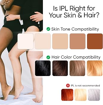 Sensica Sensilight PRO IPL Hair Removal Device – Powerful Cordless At-Home Hair Remover for Women & Men, 6 Energy Levels, 2 Treatment Windows, Patented RPL™ Advanced Technology, Full Body & Face