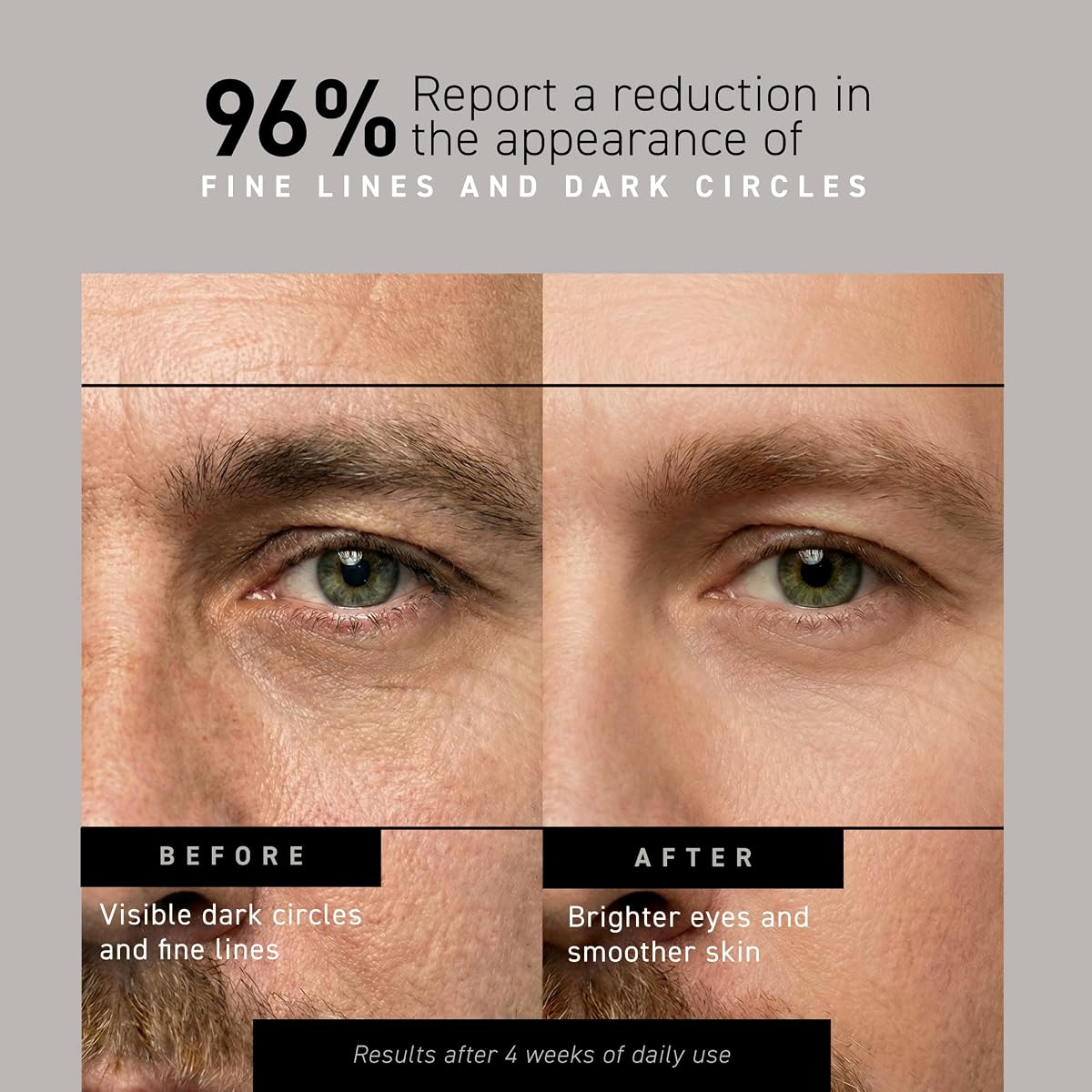 Brickell Men's Restoring Under Eye Cream for Men, Anti Aging Eye Balm To Reduce Puffiness, Wrinkles, Dark Circles, Crows Feet & Eye Bags, Caffeine, Hyaluronic Acid & Protein Peptides, 0.5oz, Unscented 0.5 Fl Oz (Pack of 1) image 1