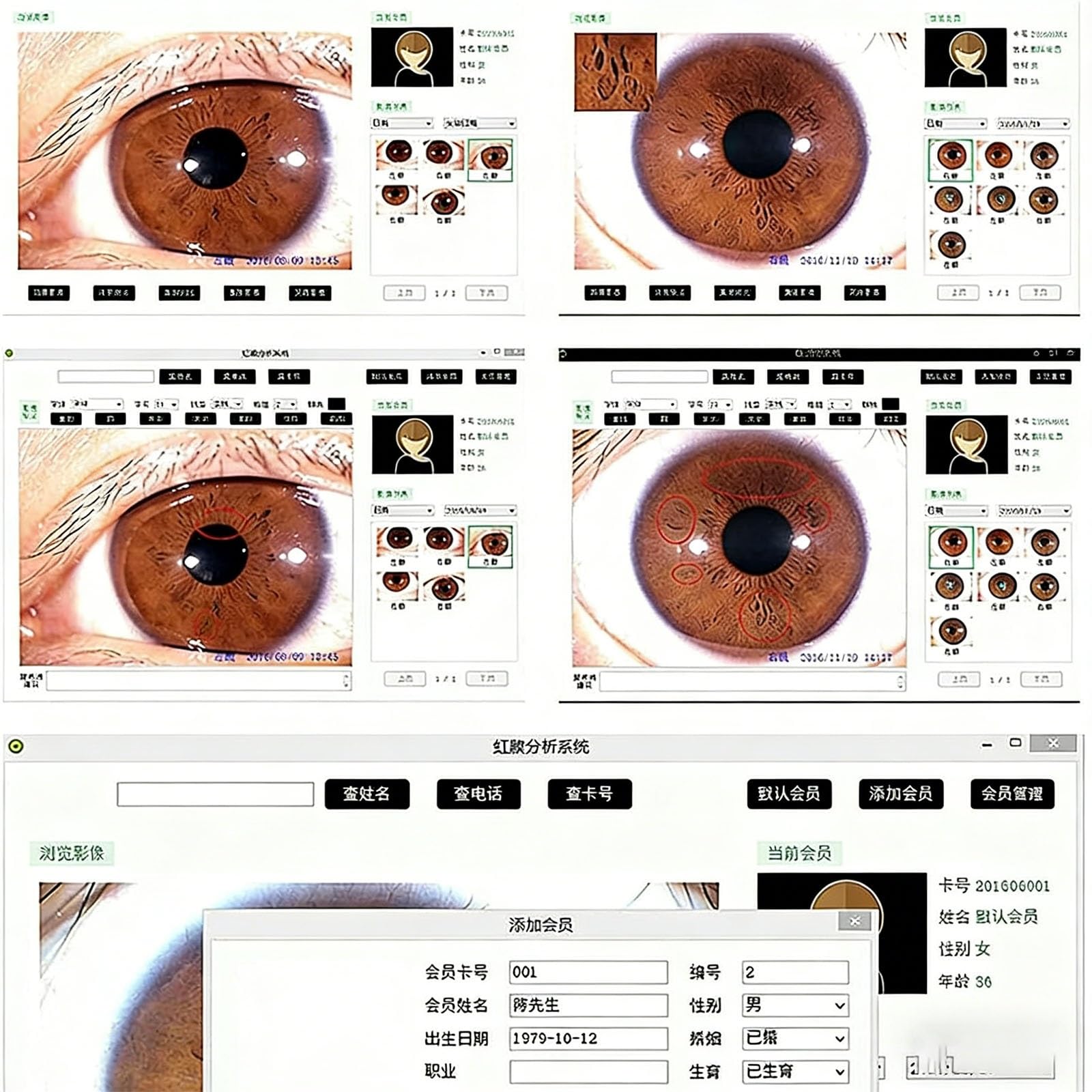 Analizador de cámara de iridología, analizador de Iris USB de 5,0 MP, cámara de iridología Ocular, análisis de Lente de Iris HD 30x, Software de análisis Pro Iris en