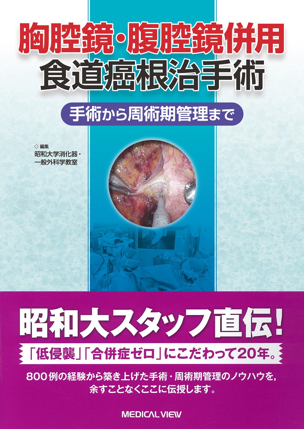 胸腔鏡・腹腔鏡併用食道癌根治手術 手術から周術期管理まで 胸腔鏡・腹腔鏡併用食道癌根治手術−手術から周術期管理まで | 昭和