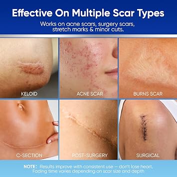 Aroamas Scar Silicone Scar Tape - Medical-Grade Silicone Scar Sheets to Help Improve the Appearance of Scars and Scratch Marks, Reusable for Face & Body [3 x 1.57, 8 Sheets]