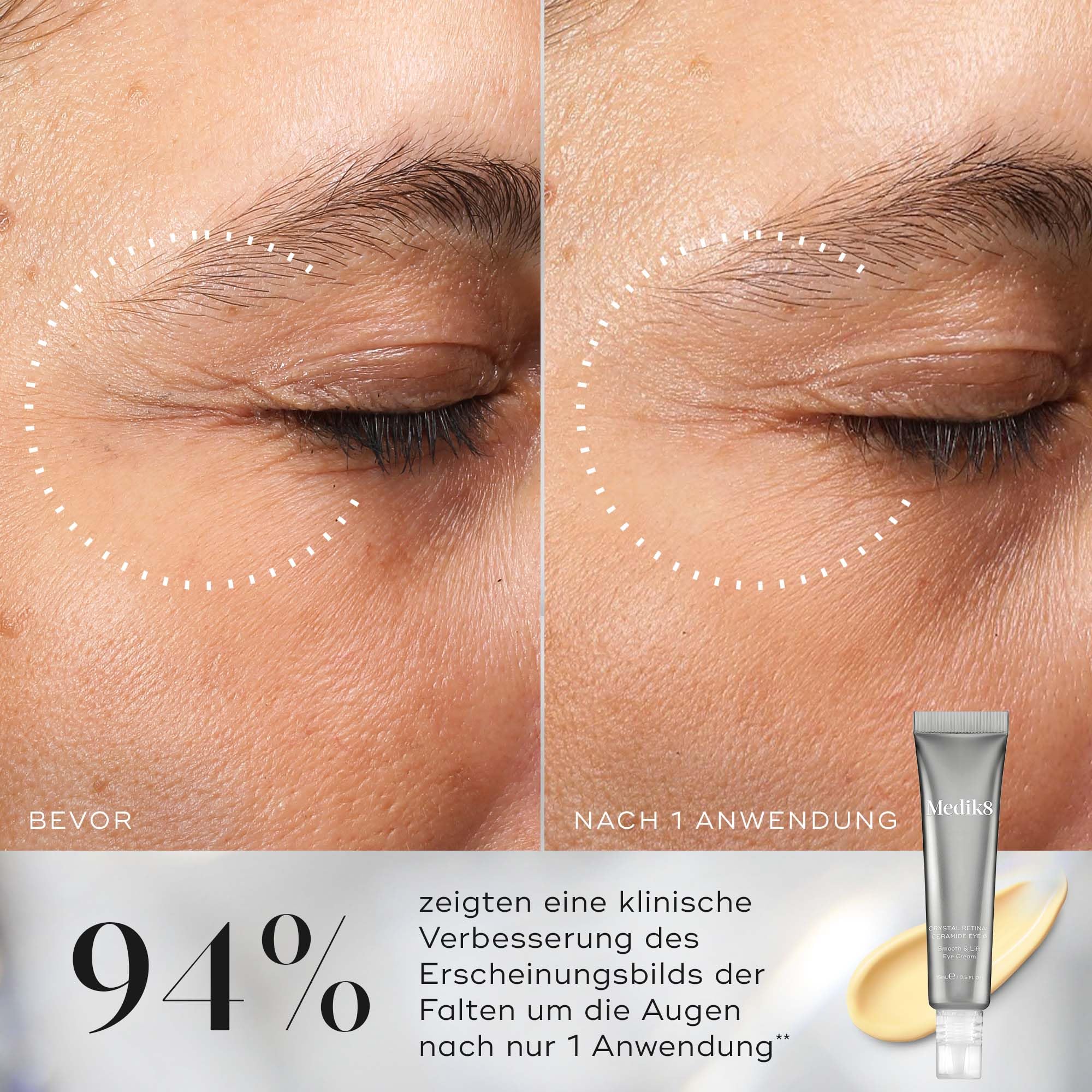 Medik8 Crystal Retinal Ceramide 10 Augencreme, 0,1% Retinal-Stärke – 15 ml | Smooth & Lift Augencreme, Anti-Aging, 0,1% Retinal (11-mal schneller wirksam als Retinol), für erfahrene Vitamin-A-Anwender