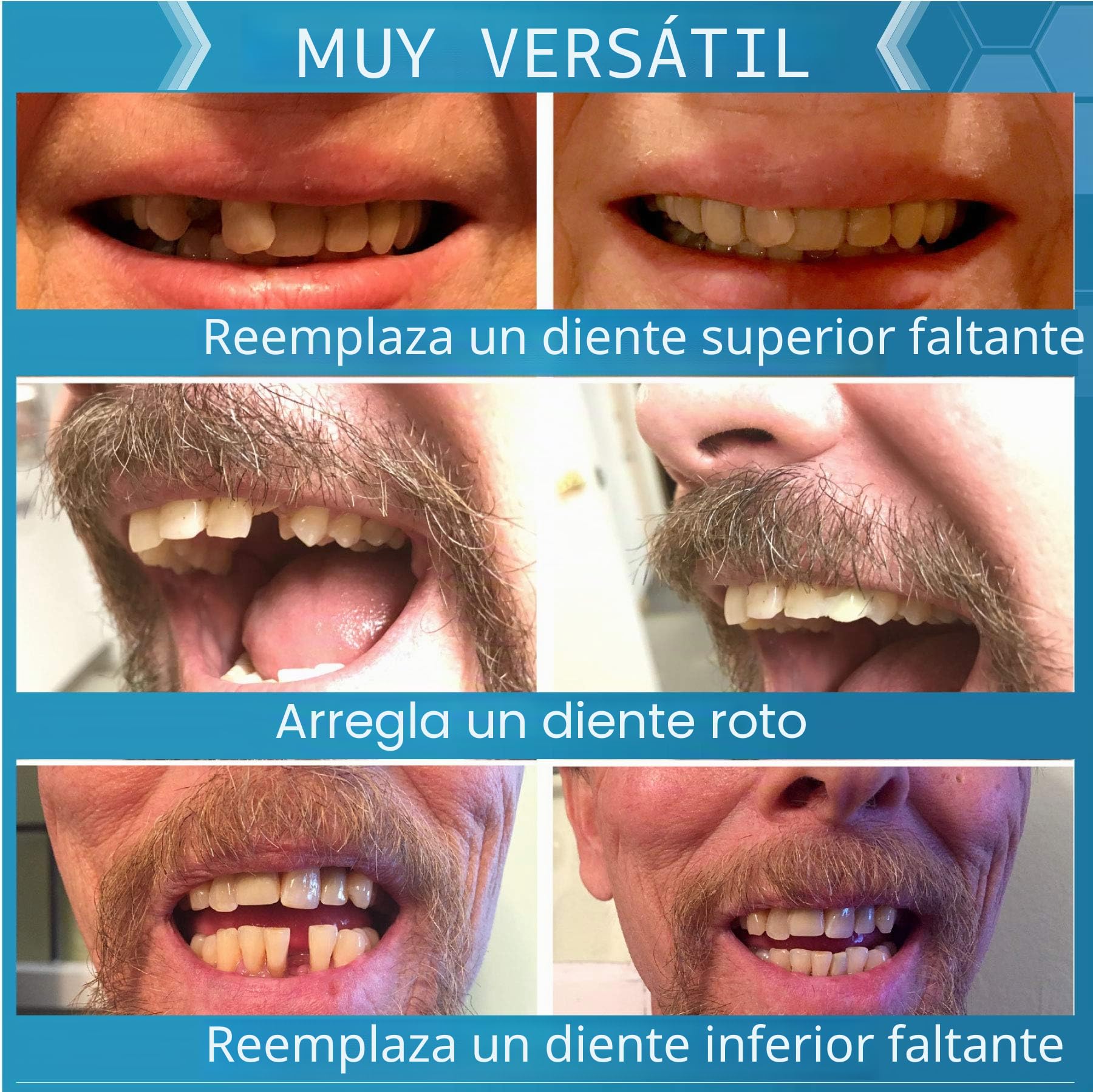 Instant Smile Completa Tu Sonrisa, Kit de Reemplazo Temporal de Dientes, Comfortable Fit, Natural Look Dentures, for Any Occasion