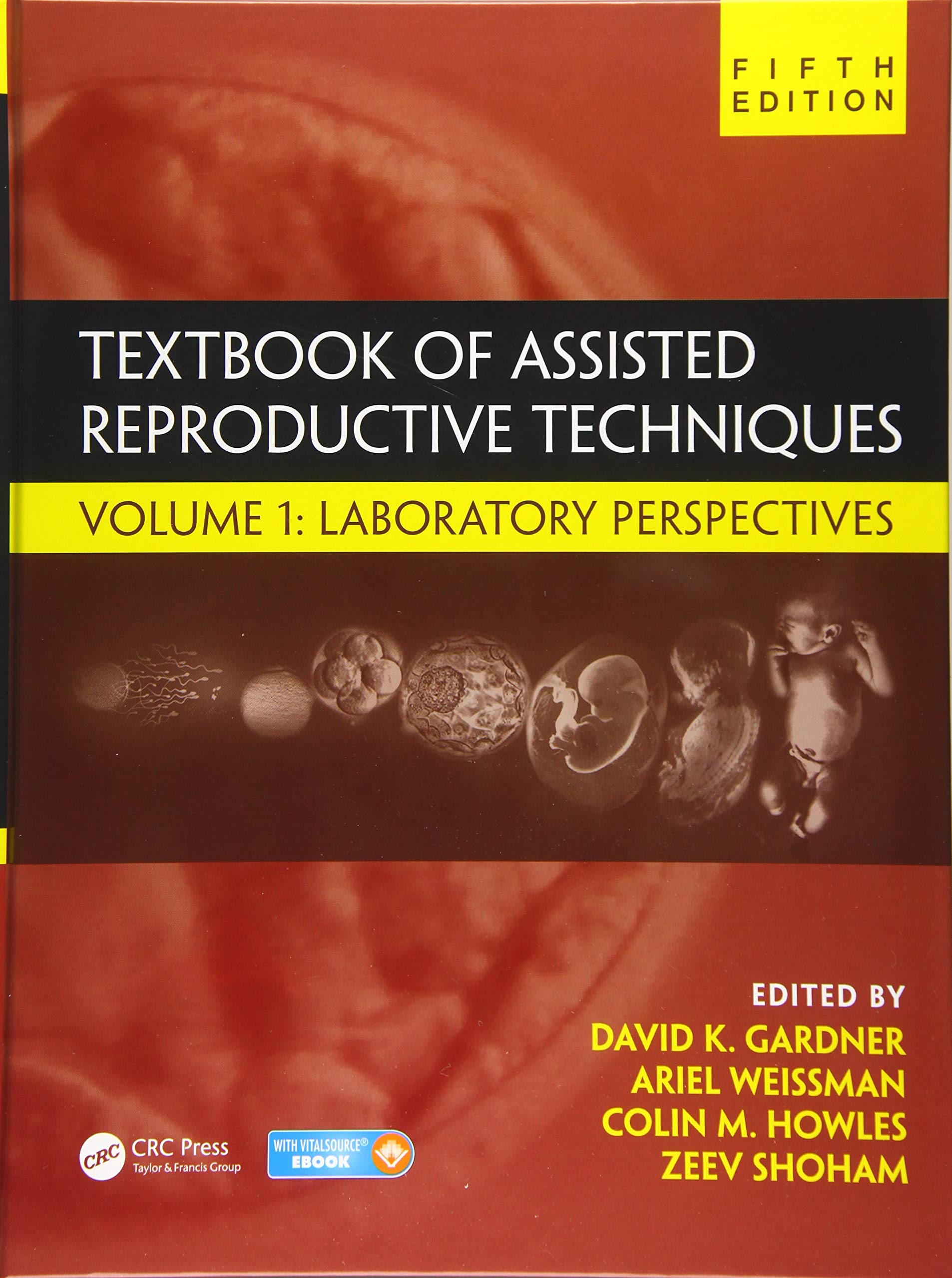 Textbook of Assisted Reproductive Techniques: Volume 1: Laboratory Perspectives Hardcover – 22 January 2018
