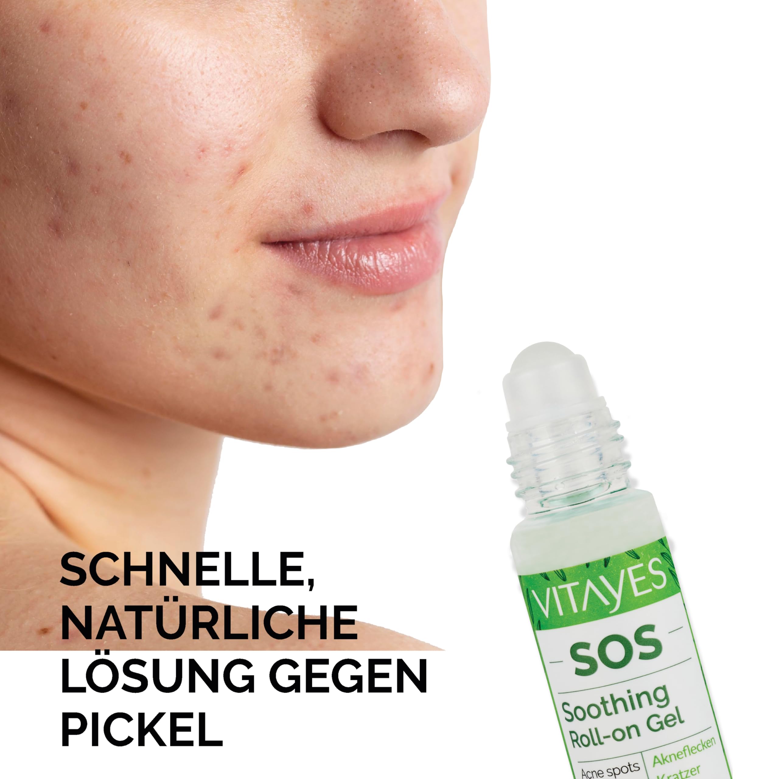 Vitayes SOS BIO Teebaumöl Roller 3x10 ml – Ätherisches Öl gegen Pickel, Akne & Hautunreinheiten – Roll-on Stift mit Vitamin B5 – Vegan & Tierversuchsfrei