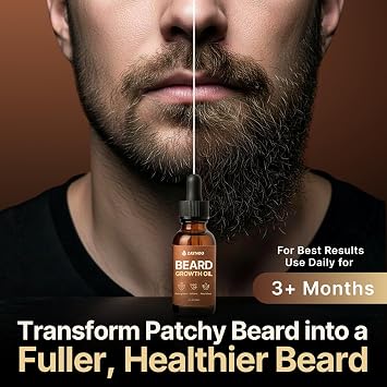 Beard Growth Oil for Men 30ml - 2x Hair Growth, Organic 100% Natural Jojoba & Argan Oil with Vitamin E in Glass Bottle for Mustache Growth, Sandalwood Beard Oil Hydrates, Softens & Soothes Dry Skin