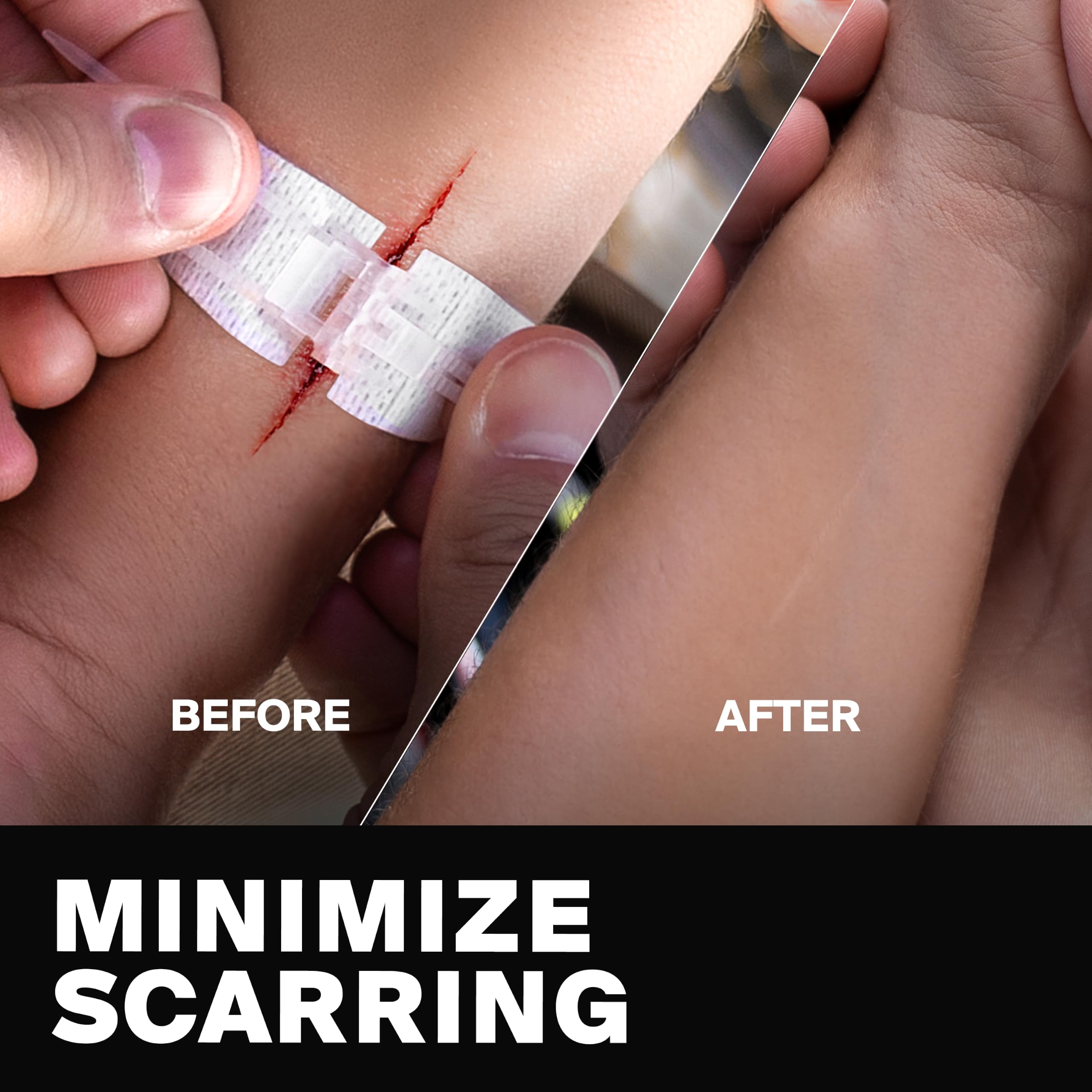 SurviveX Zip Stitch Wound Closure Kit - No Stitches Needed — Amazon image 7