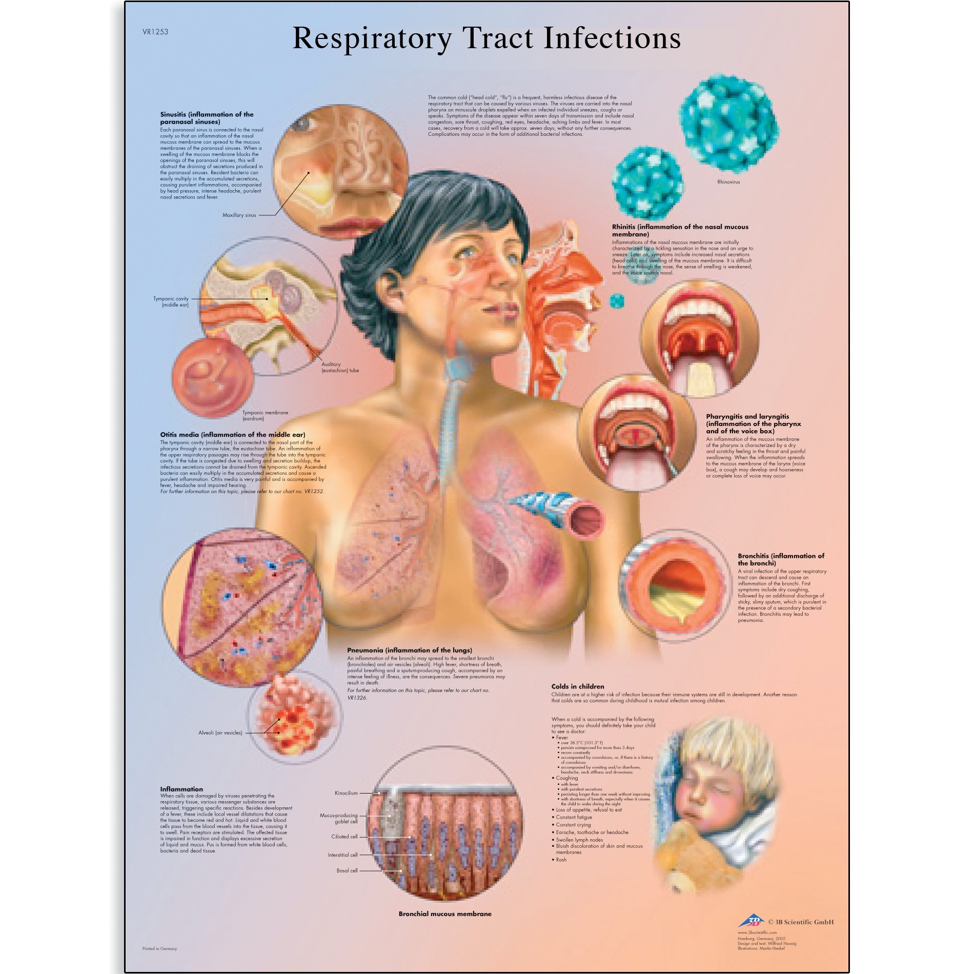 3B Scientific VR1253UU Glossy Paper Respiratory Tract Infections Anatomical Chart, Poster Size 20" Width x 26" Height