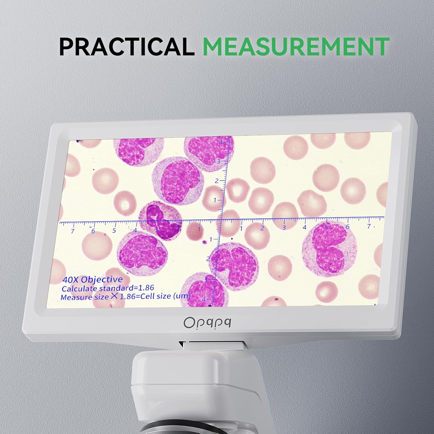 Microscope screen displaying a specimen with a measurement scale overlay.