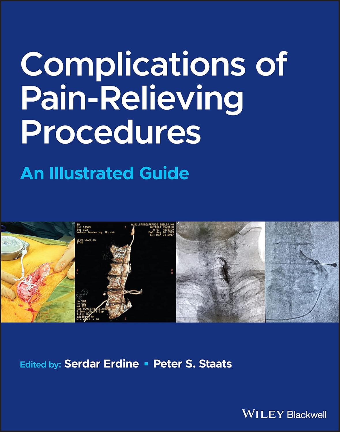 Complications of Pain-Relieving Procedures: An Illustrated Guide ...