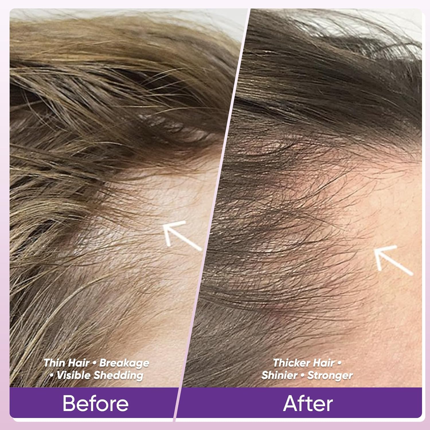 WGYPEU Hair Growth Vitamins, Biotin 10,000mcg, Collagen, Saw PalmettoA, C, D3, E, Complex, Naturally Regrow Stronger & Healthier Hair, Skin and Nails, Stops Hair Loss, 60 Day Supply - Image 3