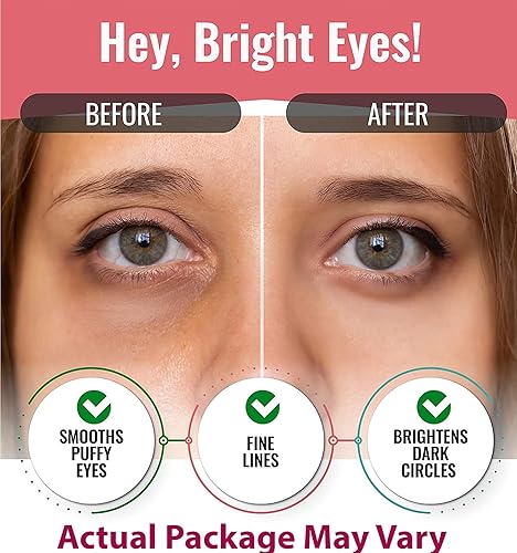 Miniatura 8 de Máscara de ojos para hinchazón  Parches debajo de los ojos para ojeras  Parches coreanos para debajo de los ojos para ojos hinchados  Almohadillas