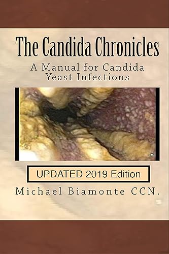 The Candida Chronicles The Updates Edition 2019