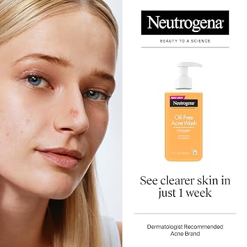 Neutrogena Oil-Free Acne Face Wash - Facial Cleanser with Salicylic Acid, Daily Cleanser for Oily & Acne-Prone Skin, Clears & Helps Prevent Breakouts, Clear Formula, 9.1 fl. oz. Bottle