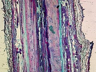 Gymnosperms Pine, Stem - Microscope Slide