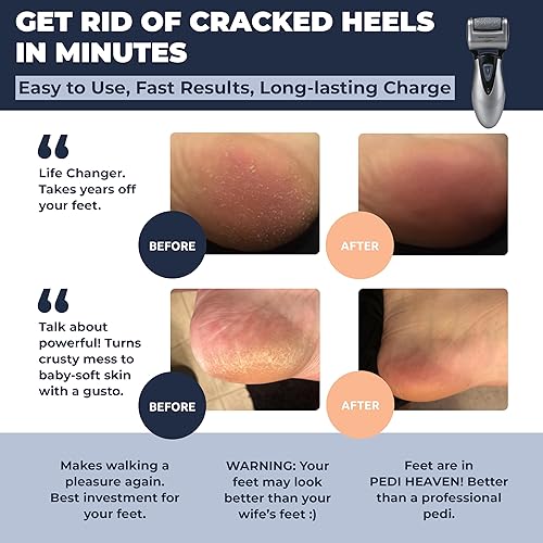 Miniatura 2 de Removedor eléctrico de callos de pies limpiador de pies kit de herramientas de pedicura recargable para hombre lima electrónico profesional para el