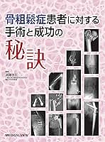 骨粗鬆症患者に対する手術と成功の秘訣 メジカルビュー社｜整形外科｜骨粗鬆症患者に対する手術と成功の秘訣