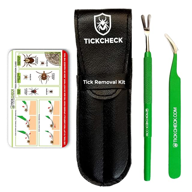 TickCheck Kit removedor de garrapatas (removedor de garrapatas de Acero Inoxidable con Pinzas