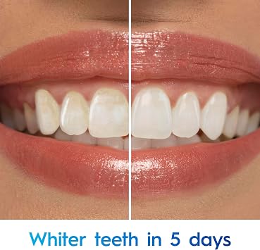 Crest Toothpaste 3DWhite Advanced Teeth Whitening, Arctic Fresh, 3.3 oz, Pack of 2