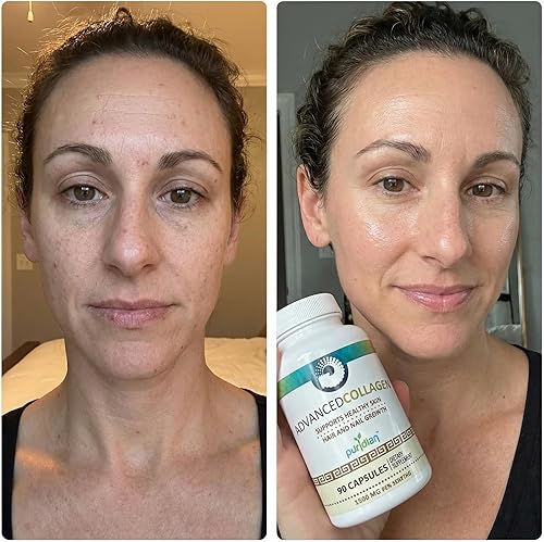 Miniatura 7 de Colágeno súper hidrolizado puro y concentrado natural en pastillas con fórmula avanzada que mejora la calidad de tu piel, cabello, articulaciones.