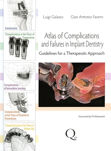 ATLAS OF COMPLICATIONS AND FAILURES IN IMPLANT DENTISTRY GUIDELINES FOR A THERAPEUTIC APPROACH (HB 2013)