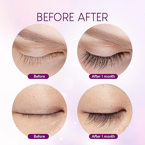 Miniatura 2 de VieBeauti Suero de crecimiento de pestañas de alta calidad mejora del suero de pestañas, suero de pestañas promueve la apariencia de pestañas más