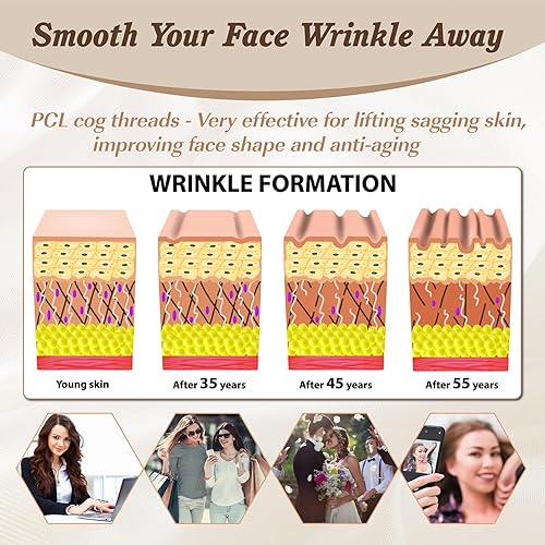 Miniatura 6 de PCL Cog Threads 4DV Face Lifting 360R Barb bidireccional (tipo L) Roscas PCL para elevación facial 21G60mm 10pcs Cogs Cogs Thread Lift para todo el