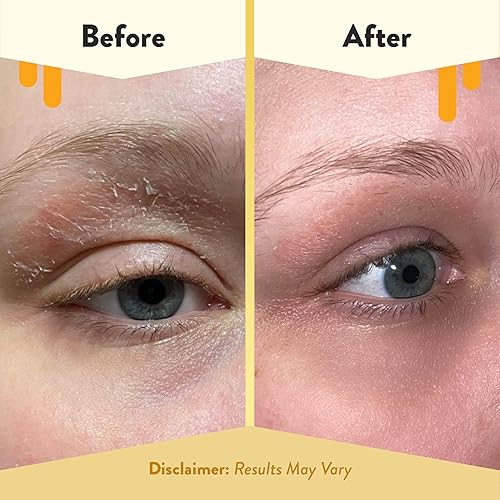 Miniatura 6 de Eczema Honey Crema de ojos multipéptido y suero facial nutritivo - Paquete para pieles sensibles y secas - Libre de crueldad