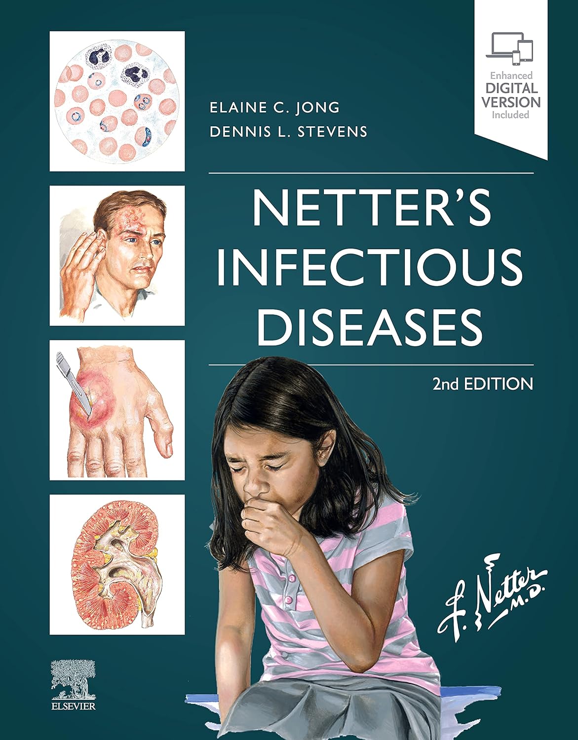 Netter's Infectious Diseases      2nd Edition