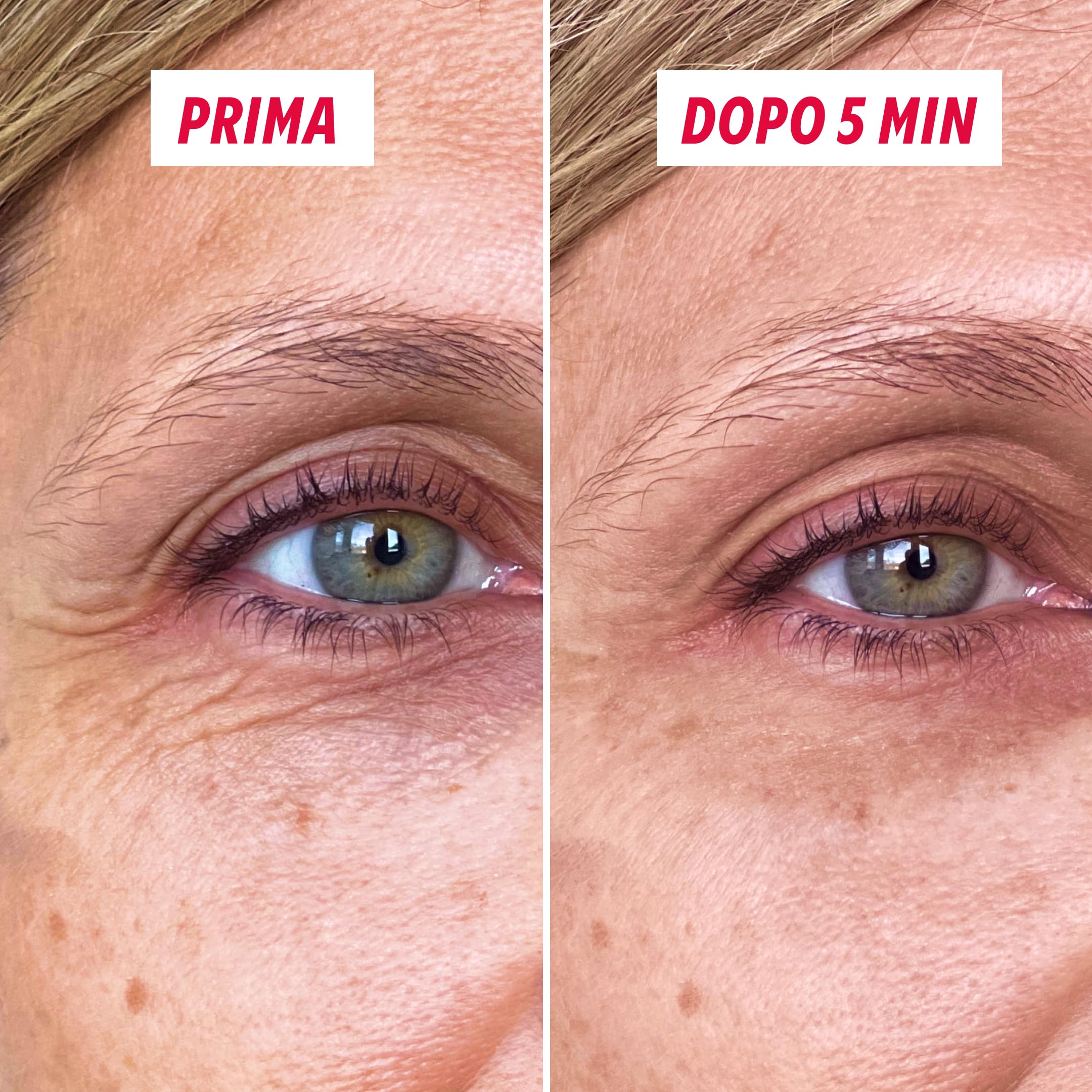 MYSOSBEAUTY - Correttore tasche e rughe, crema lifting temporanea per contorno occhi, anti-età, trattamento lifting istantaneo per 8 ore, riduce le tasche sotto gli occhi (15 ml)