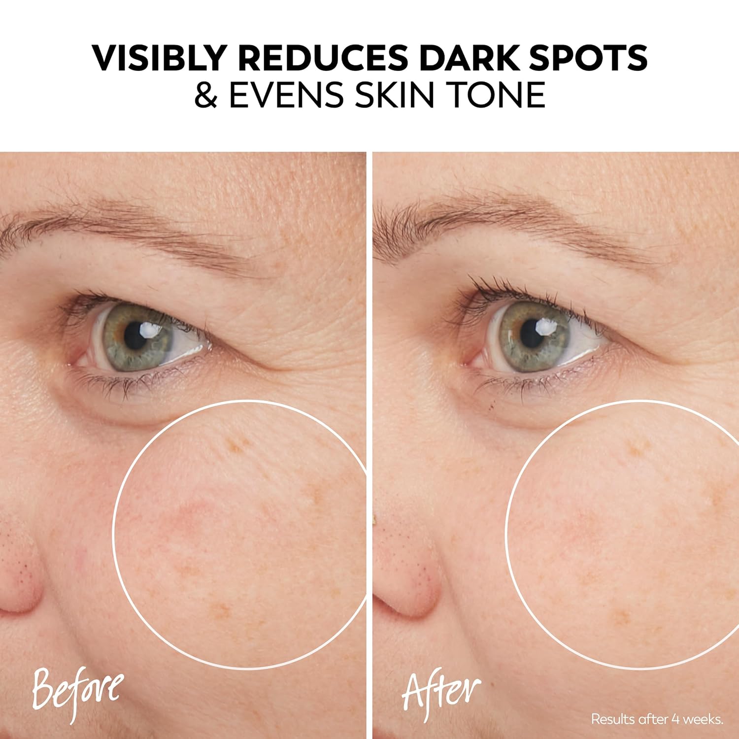 Olay Pro-X Dermatological Even Skin Tone Spot Fading Treatment Serum, 1.3 oz - Image 4