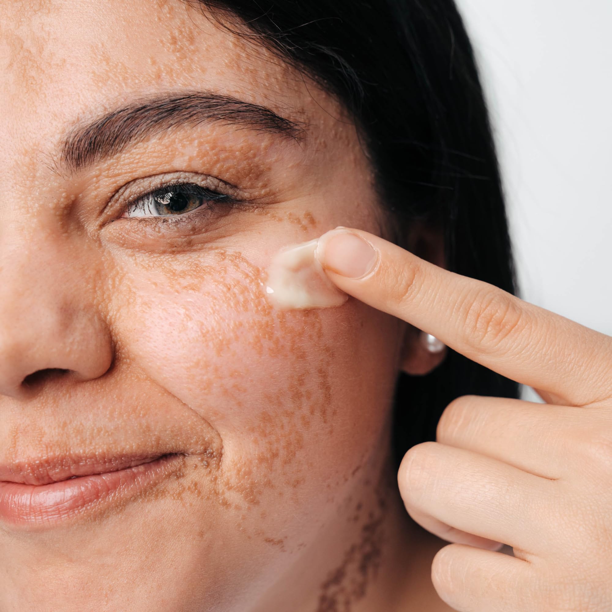 Skinius FOSPID Siero Viso Attivo con Fospidina - Azione Rigenerante Anti-Aging - Aiuta a Restituire Tono Densità e Luminosità alla Pelle - 30ml
