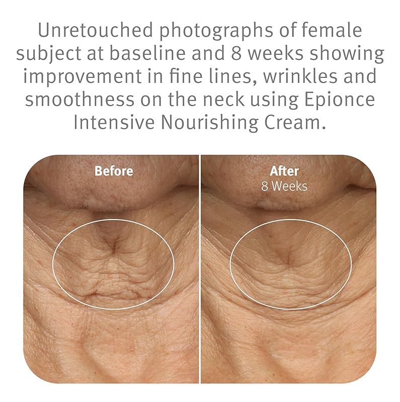 Key botanical ingredients in nourishing cream