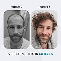 Vista 3 de Suero para el crecimiento del cabello para hombres, tratamiento extra fuerte para el cuero cabelludo con biotina y activos botánicos, clínicamente